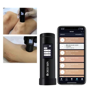 Skin Color Testing Machine for Permanent Makeup 2000+ Intelligent Color Matching for Skin Camouflage - AliExpress 66